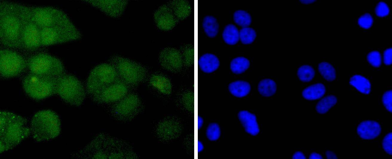 Anti-Phospho-AKT1 (Ser124) Antibody (1H96)