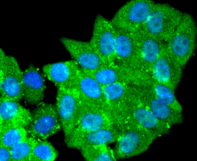Anti-PARK7/DJ1 Antibody (9Q473)