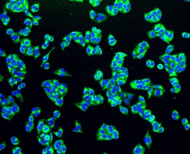 Anti-TSPO Antibody (9Y314)