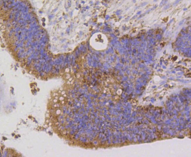 Anti-TSPO Antibody (9Y314)