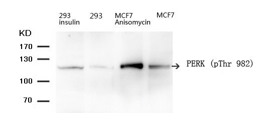 Anti-Phospho-PERK (Thr 981) Polyclonal Antibody