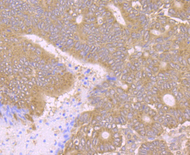 Anti-PCK2 Antibody (4S45)