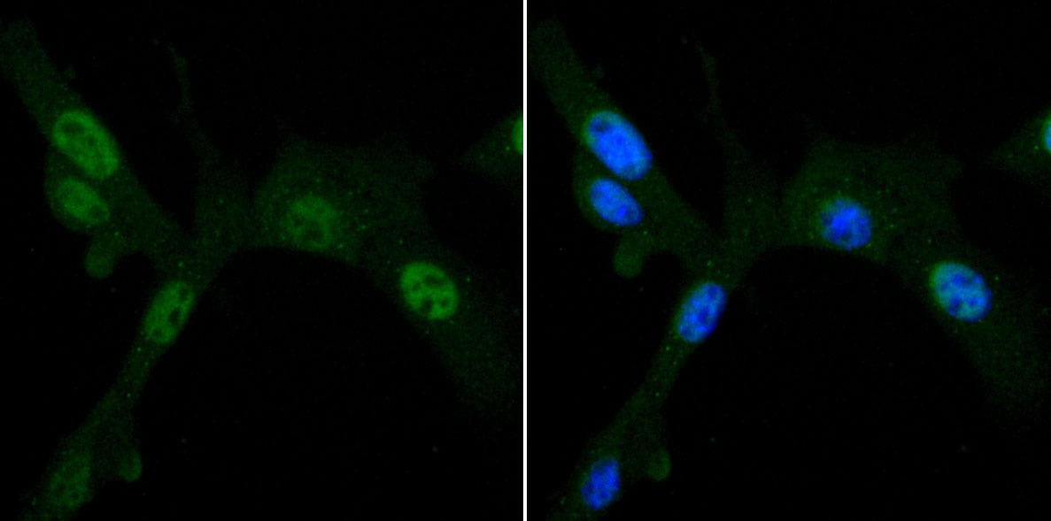 Anti-PDK1 Antibody (2G768)