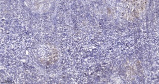 Anti-Phospho-CD31 (Tyr713) Polyclonal Antibody