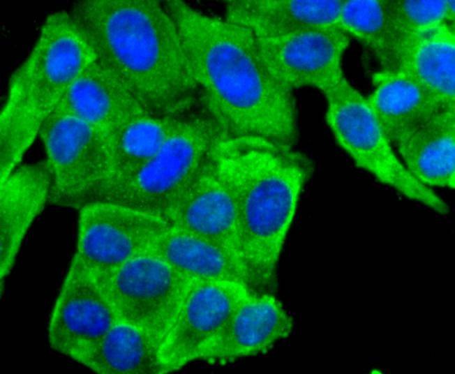 Anti-Peroxiredoxin 2 Antibody (6A598)
