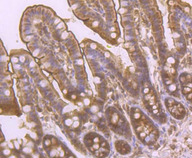 Anti-PCK2 Antibody (4S45)