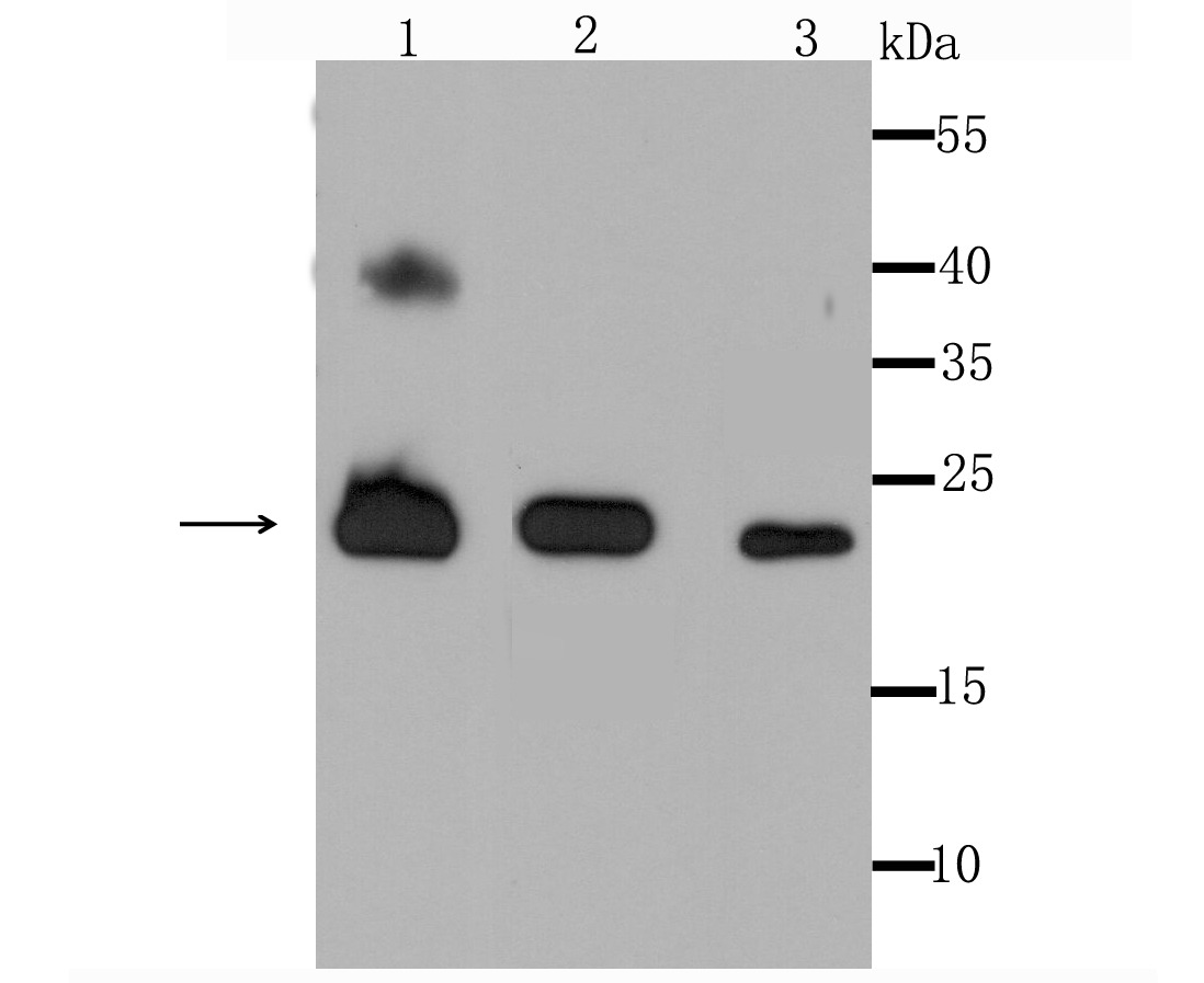 Anti-PRDX3 Antibody (7V569)