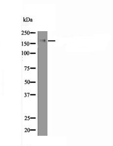 Anti-Phospho-PERK (Ser1094) Polyclonal Antibody