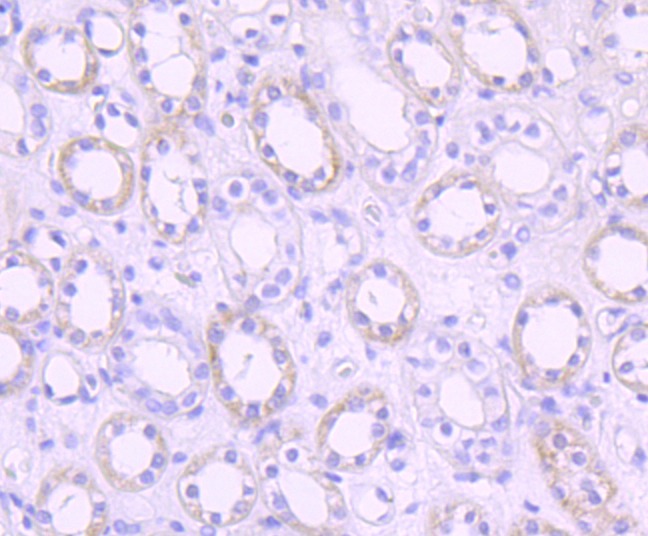 Anti-PDK1 Antibody (2G768)