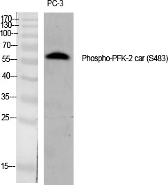 Anti-Phospho-PFKFB2 (Ser483) Polyclonal Antibody
