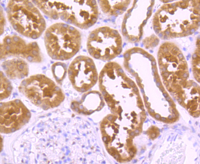 Anti-Peroxiredoxin 1 Antibody (9D82)
