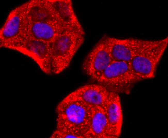 Anti-Perilipin A Antibody (2U427)