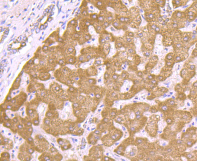 Anti-PCK1 Antibody (7Q973)