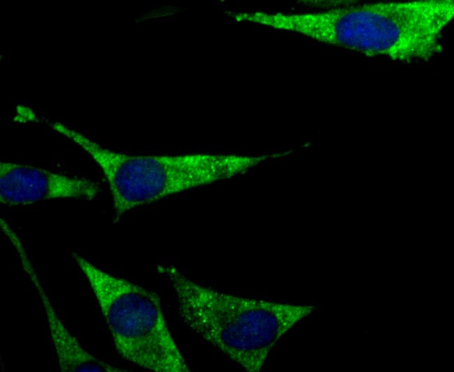 Anti-PCK1 Antibody (7Q973)