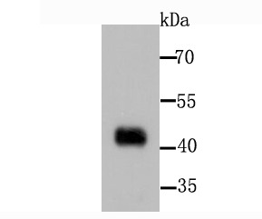 Anti-PDK1 Antibody (2G768)