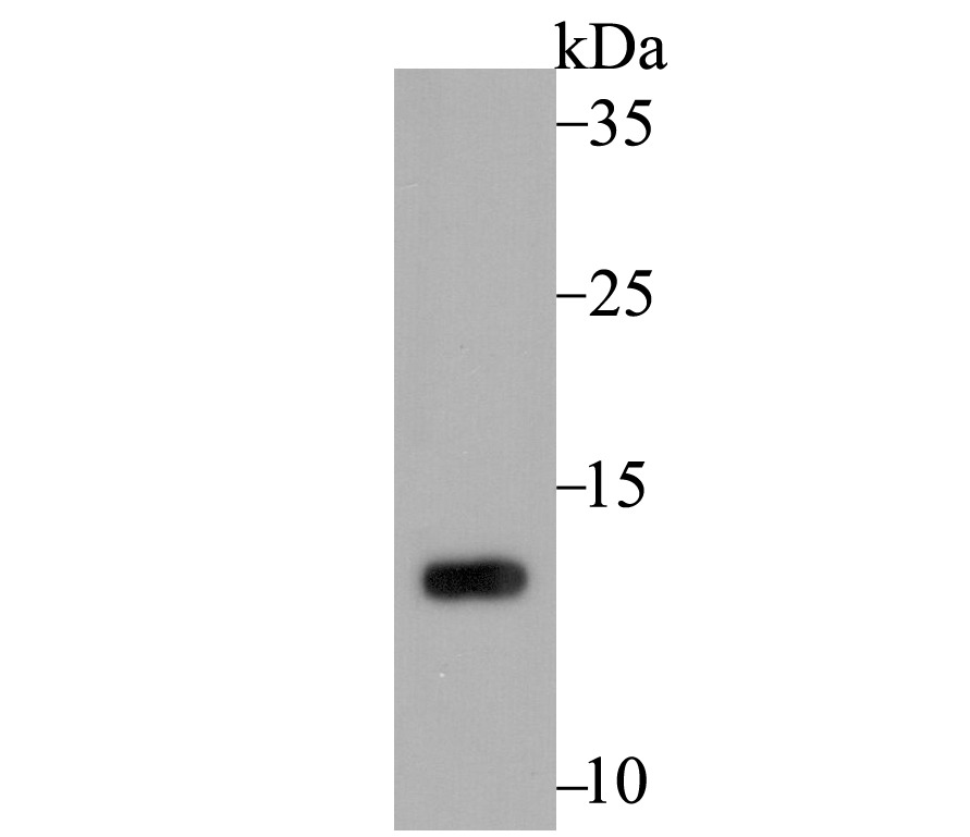 Anti-PSENEN Antibody (3P624)