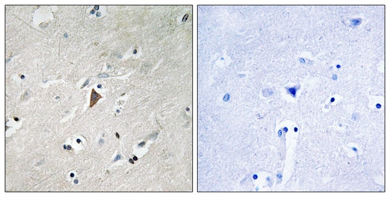 Anti-Phospho-PDK1 (Tyr9) Polyclonal Antibody