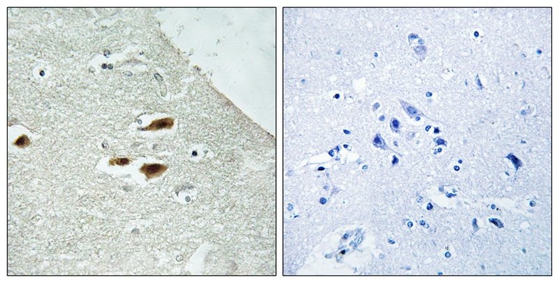 Anti-Phospho-Period Circadian Protein 2 (Ser662) Polyclonal Antibody