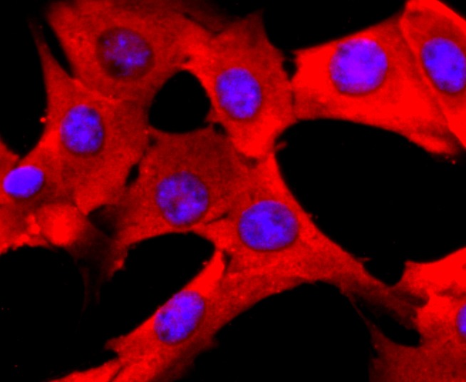 Anti-PDIA6 Antibody (6G49)