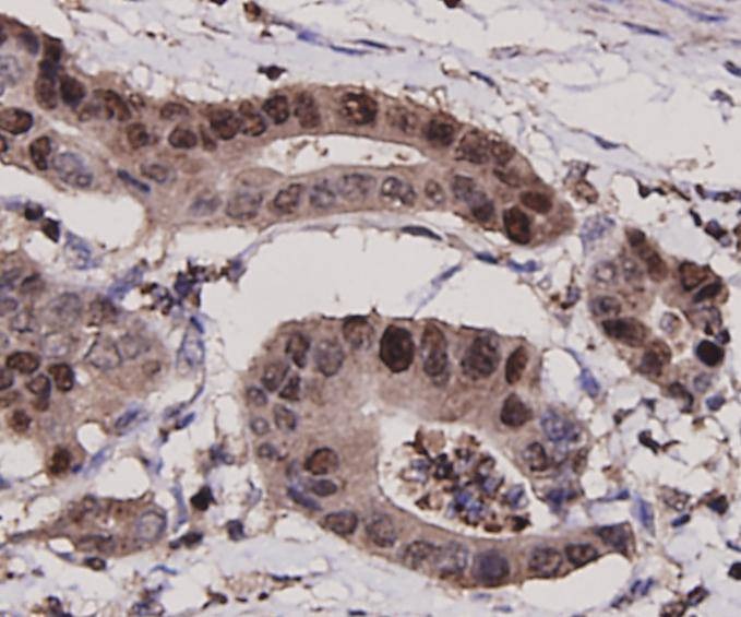 Anti-PCNA Antibody (8X645)