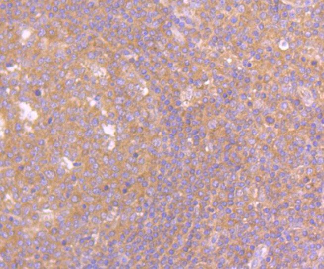 Anti-PSENEN Antibody (3P624)