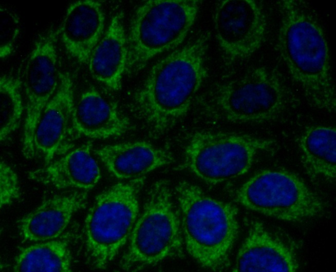 Anti-PRDX3 Antibody (7V569)