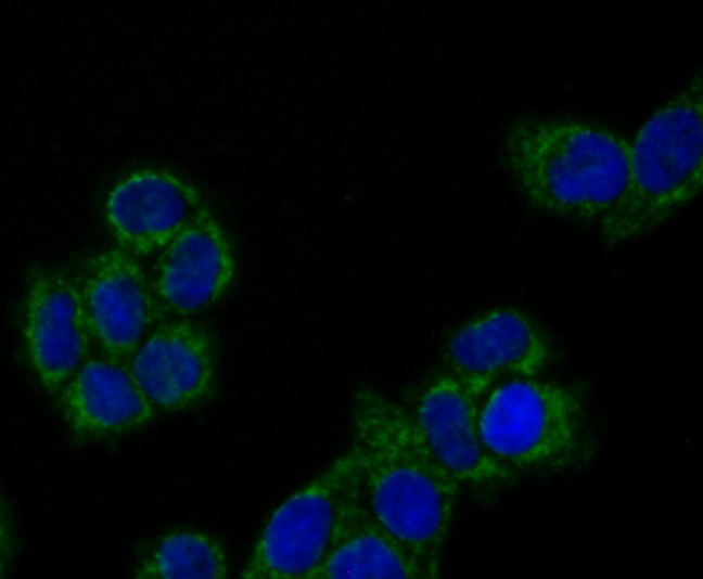Anti-PRDX3 Antibody (7V569)