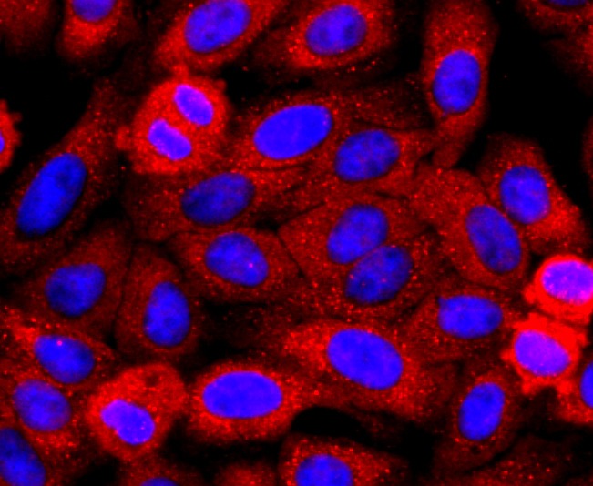 Anti-Perilipin A Antibody (2U427)