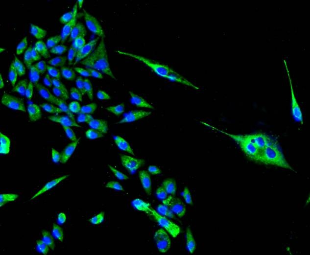 Anti-TSPO Antibody (9Y314)