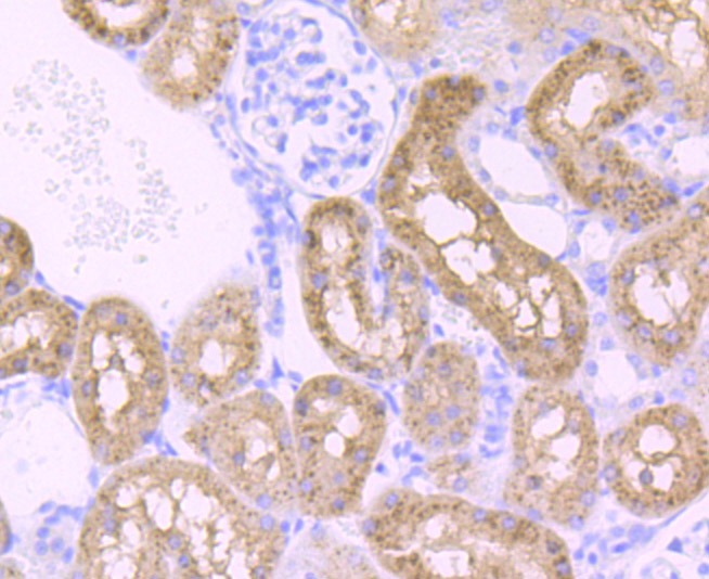 Anti-PCK2 Antibody (4S45)