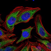 Anti-PDK1 Antibody (4S37)