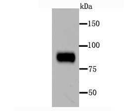 Anti-Periostin/OSF-2 Antibody (5Q795)