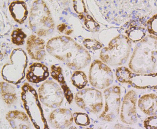 Anti-TSPO Antibody (9Y314)