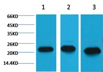 Anti-Peroxiredoxin 1 Antibody (8J261)