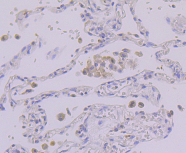 Anti-PSENEN Antibody (3P624)