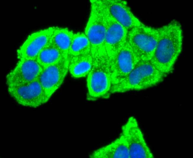 Anti-Peroxiredoxin 2 Antibody (6A598)