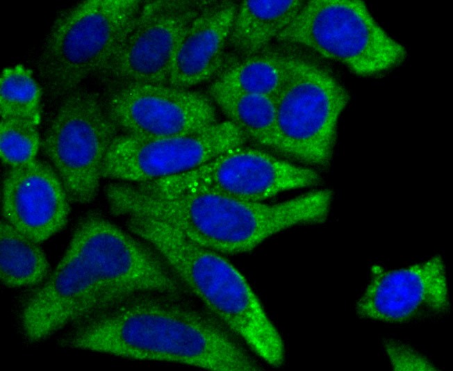 Anti-PCK1 Antibody (7Q973)