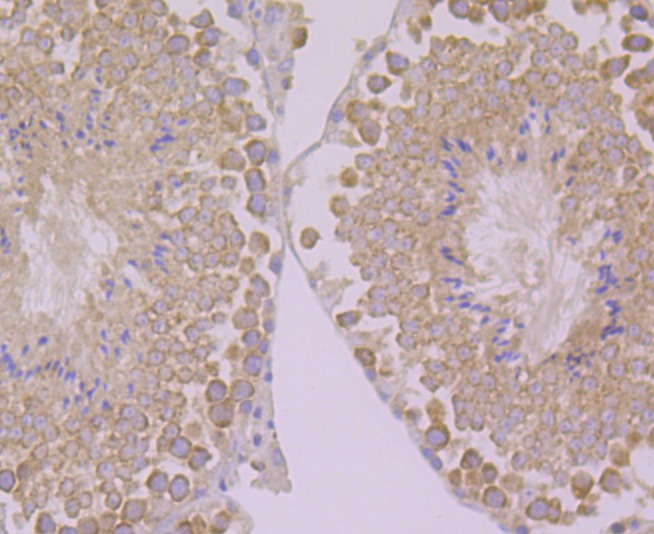 Anti-PSENEN Antibody (3P624)