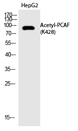 Anti-Acetyl-PCAF (Lys428) Polyclonal Antibody