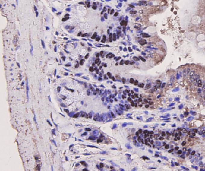 Anti-PCNA Antibody (8X645)