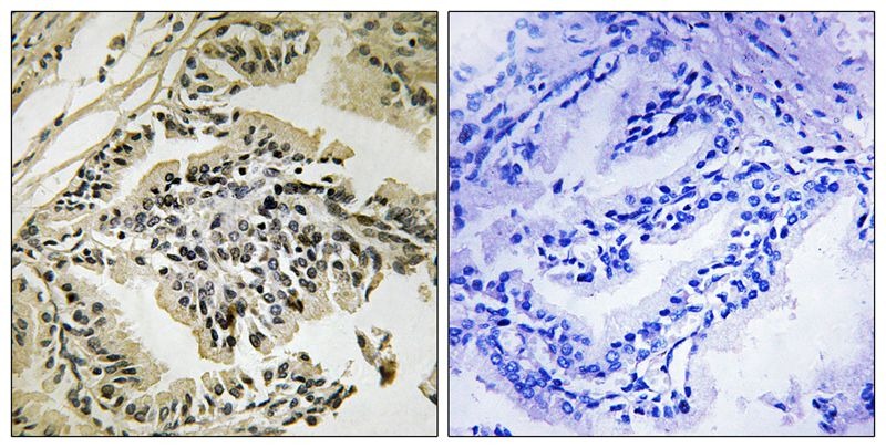 Anti-Phospho-PERK (Thr982) Polyclonal Antibody 2