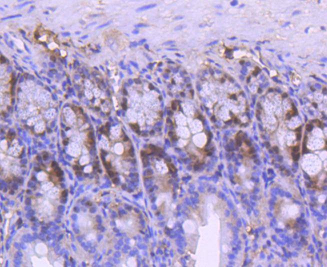 Anti-PCNA Antibody (2C751)