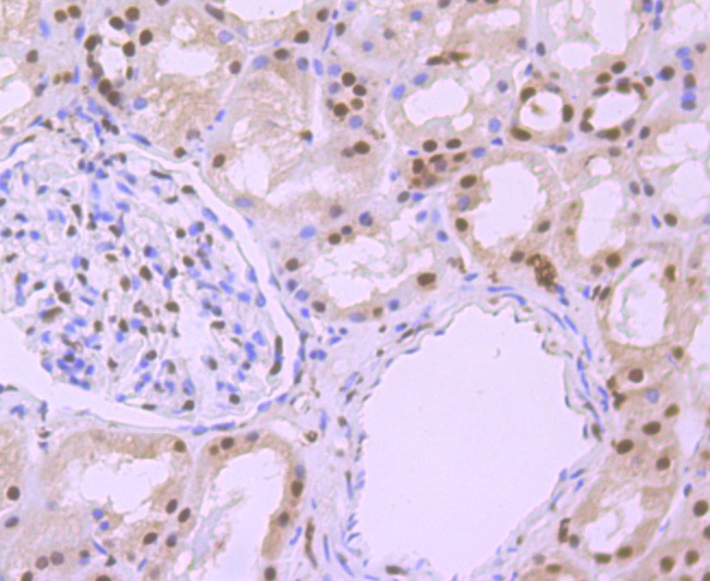 Anti-Phospho-Alpha-Synuclein (Ser129) Antibody (7E158)