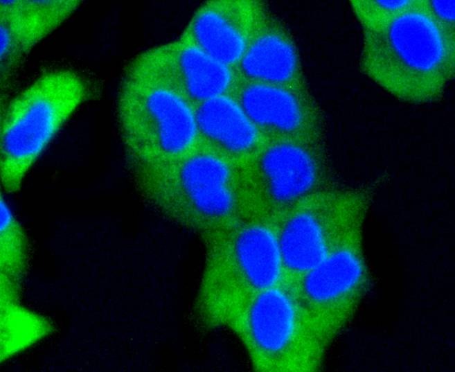 Anti-EGLN2 Antibody (7L776)