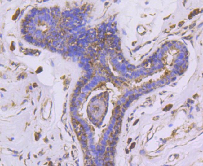 Anti-EGLN2 Antibody (7L776)