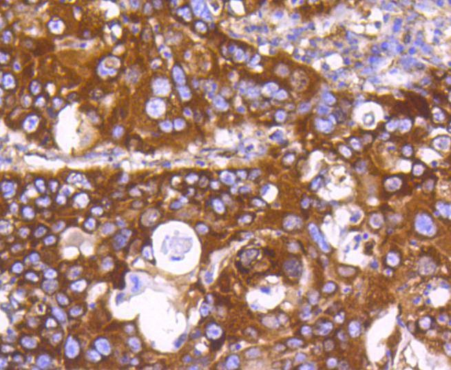 Anti-EGLN2 Antibody (7L776)