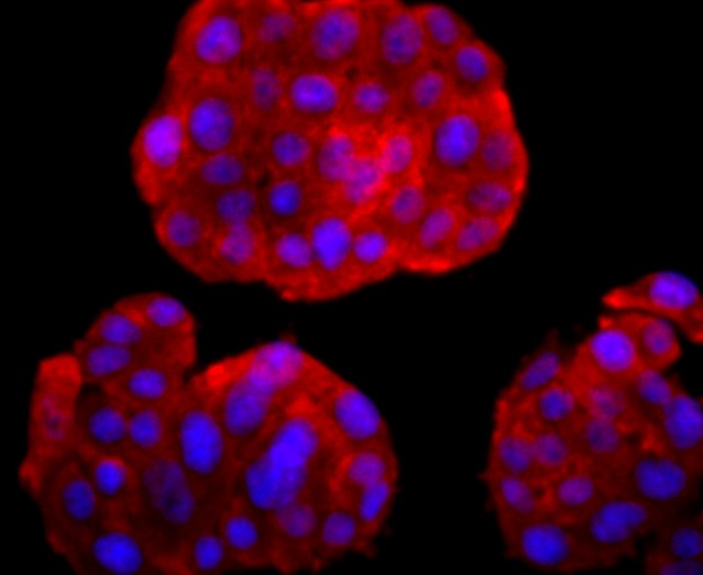 Anti-UCHL1 Antibody (2X729)