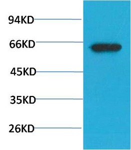 Anti-Phospho-AKT1 (S473) Antibody (6W615)