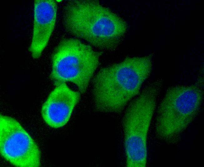 Anti-EGLN2 Antibody (7L776)