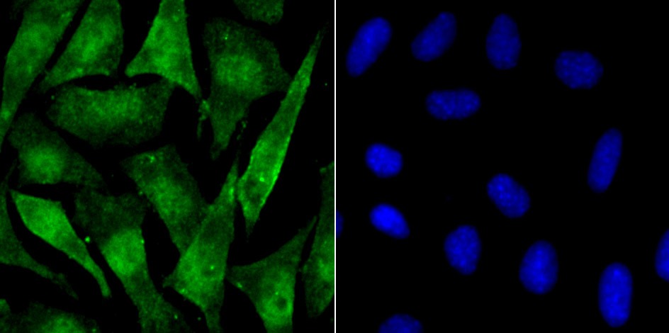 Anti-Phospho-Alpha-Synuclein (Ser129) Antibody (7E158)